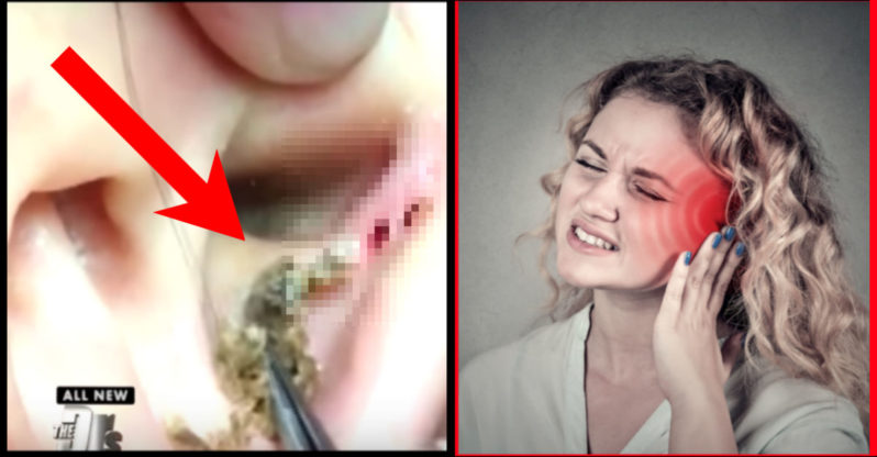 Listen Up! Doctors Warn Wearing Headphones Could Cause Blackheads in Your EAR